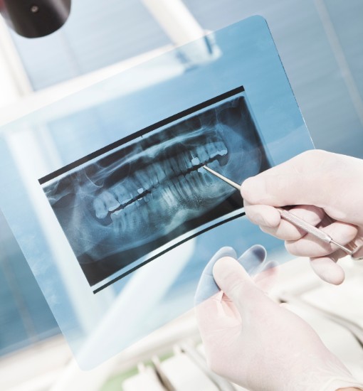 Dental X-Rays, Langley Dentist